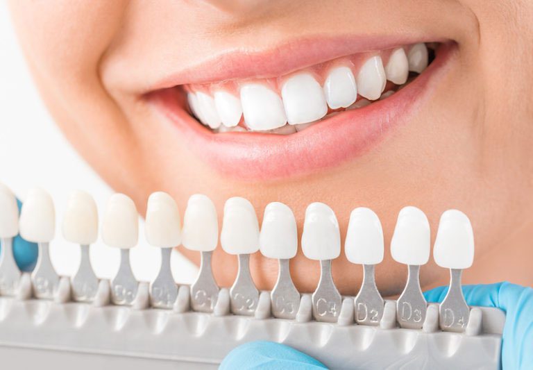 Row of implants in front of smiling face